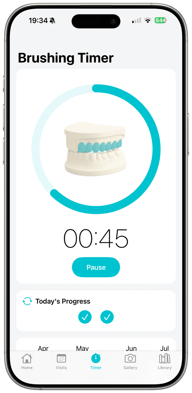 Bracie brushing timer and heat map